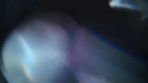 Organic Bokeh 01 Video stock 230461412