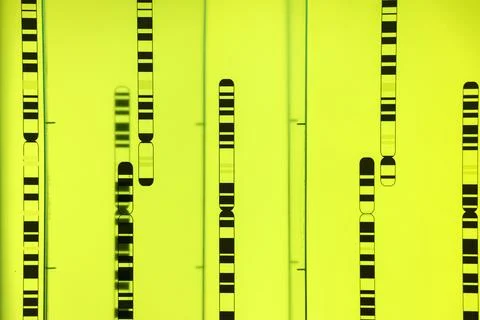Organization of the genome into chromosomes Stock Photos