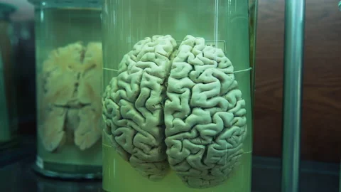 Organs in anatomical museum Video stock 153967477