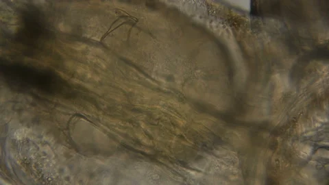 Organs of a mosquito larva under a microscope Stock Footage 89386200