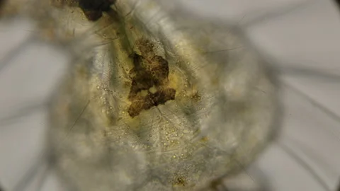Organs of a mosquito larva under a microscope Stock Footage 92297862
