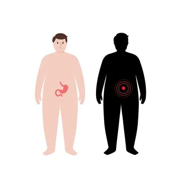 Organs in obese human body Stock Illustration