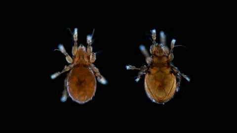 Oribatida mite (Acari), under the microscope Stock Footage 106152528