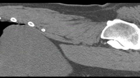 Original CT scan of human spine Stock Footage 335592