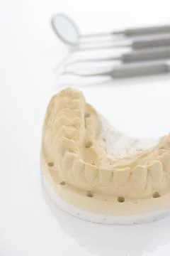 Orthodontic Cast Stock Photos