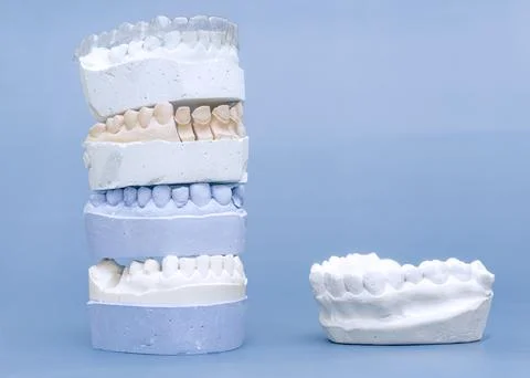 Orthodontic concept: vertical stack of dental gypsum molds with invisible bra 스톡 사진