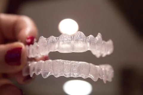Orthodontics to correct alignment of teeth Stock Photos