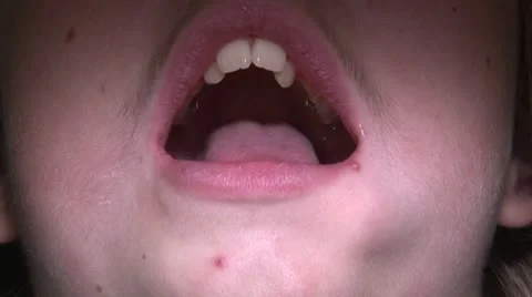 At the orthodontist cabinet Stock Footage
