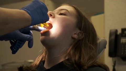 Orthodontist Dentist Impression Of Upper And Lower Teeth Mould Size Test Stock Footage 125873042