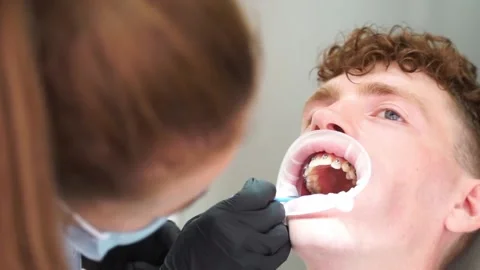 An orthodontist examines the fixed braces Video stock 167303743