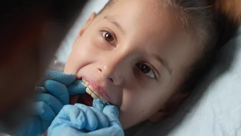 Orthodontist explaining dental braces for teeth correction. Dentist showing.. Stock Footage 289828639