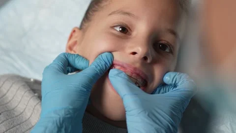 Orthodontist explaining dental braces for teeth correction. Dentist showing.. Stock Footage 289828880