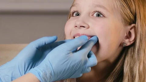 Orthodontist inserts a plate to align the teeth and correct the bite of a child Stock Footage 124069954