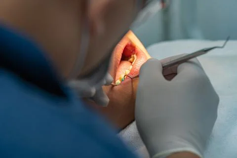 Orthodontist using dental scaler while doing check-up for client Stock Photos