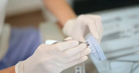 Orthodontist working with jaw model applying brace system Stock Footage 147888161