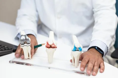 Orthopedic doctor explaining knee implants Stock Photos