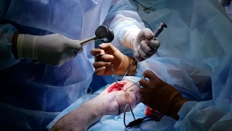 Orthopedic surgeons carefully operating, using specialized instruments for Stock Photos