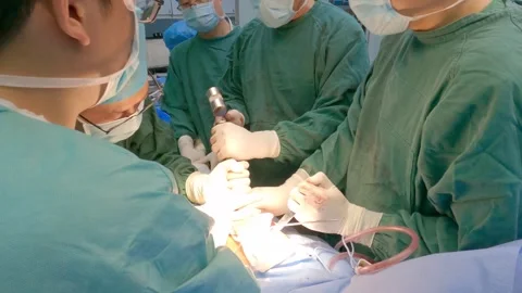 Orthopedic Surgeons Using Mallet to Install Implant with Precision" Stock Footage 243542180