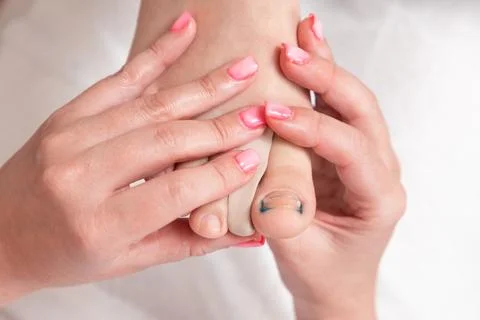 Orthopedist inserts a silicone impression between the toes to correct the ing 写真素材