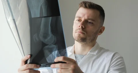 Orthopedist is learning bones on x-ray images standing near the window. Vídeo Stock 108021291