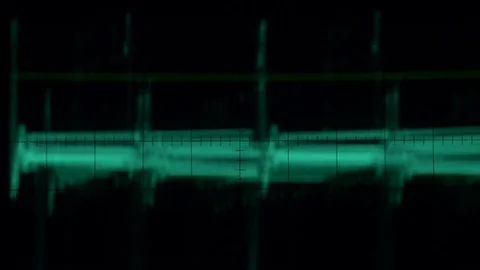 OSCILLOSCOPE CREATES CRAZY LIGHT PATTERNS, LOOP-ABLE Stockbeeldmateriaal 78157473