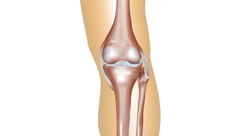 Osteoarthritis and normal joint Stock Footage 70100922