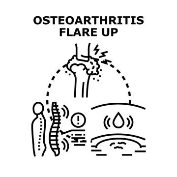 Osteoarthritis flare up causing joint and spinal pain Stock Illustration