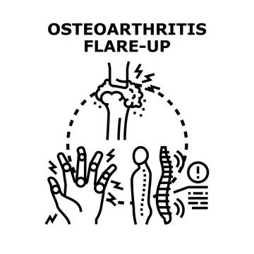 Osteoarthritis flare up causing joint and spinal pain Stock Illustration