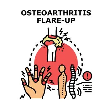 Osteoarthritis flare up causing joint and spinal pain Stock Illustration