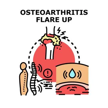 Osteoarthritis flare up causing joint and spinal pain Stock Illustration