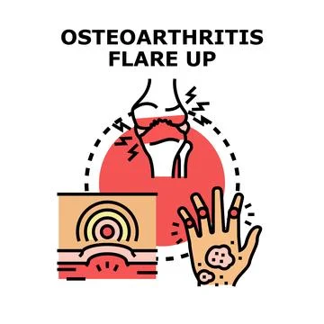 Osteoarthritis flare up causing joint pain and inflammation Stock Illustration