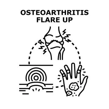 Osteoarthritis flare up causing joint pain and inflammation Stock Illustration