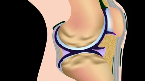 Osteoarthritis Video stock 7136538