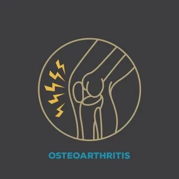 Osteoarthritis Stock Illustration