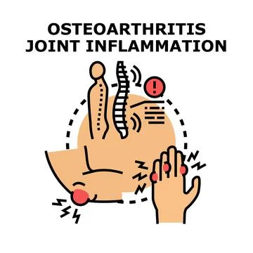 Osteoarthritis joint inflammation concept vector illustration Illustrazione stock