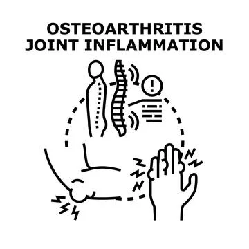 Osteoarthritis joint inflammation concept vector illustration イラスト素材