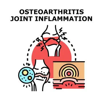 Osteoarthritis joint inflammation concept vector illustration Stock Illustration