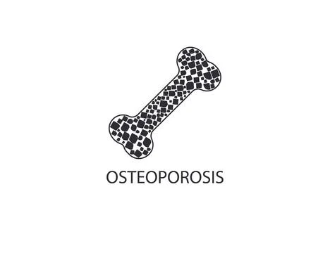 Osteoporosis, bone, disease icon. Vector illustration. Иллюстрация