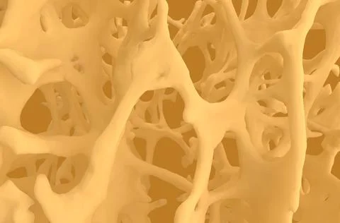 Osteoporosis bone structure 스톡 일러스트