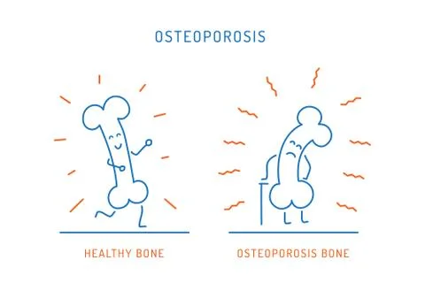Osteoporosis cartoon bone Stock Illustration