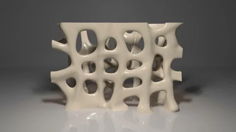 Osteoporosis Condition Video stock 126940419