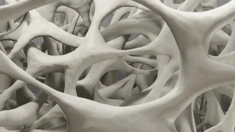 Osteoporosis Stock Footage 213988445