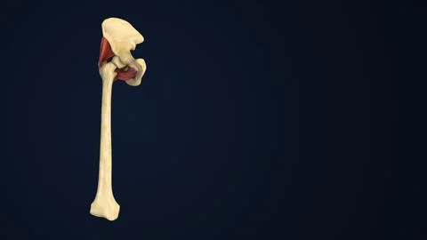 Osteoporosis Process in Leg Bone Illustrazione stock