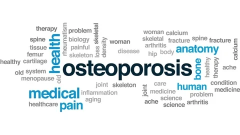 Osteoporosis state animated word cloud, ... | Stock Video | Pond5 Osteoporosis state animated word cloud, ... | Stock Video | Pond5