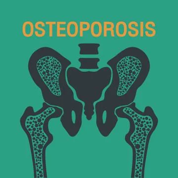 OSTEOPOROSIS vector logo icon design Stock Illustration