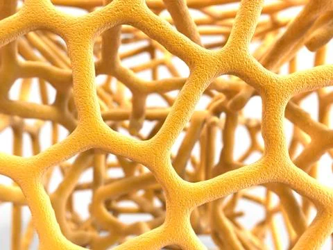 Osteoporotic bone, artwork イラスト素材