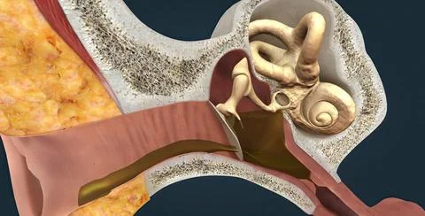 Otitis media is another name for a middle-ear infection. Stock Illustration
