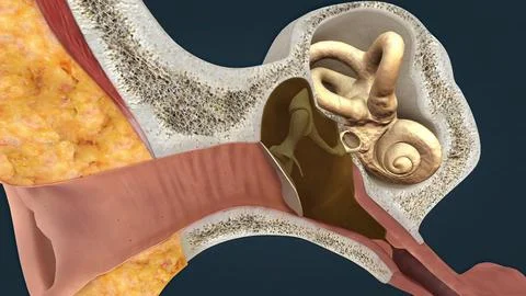 Otitis media is another name for a middle-ear infection. Stock Illustration