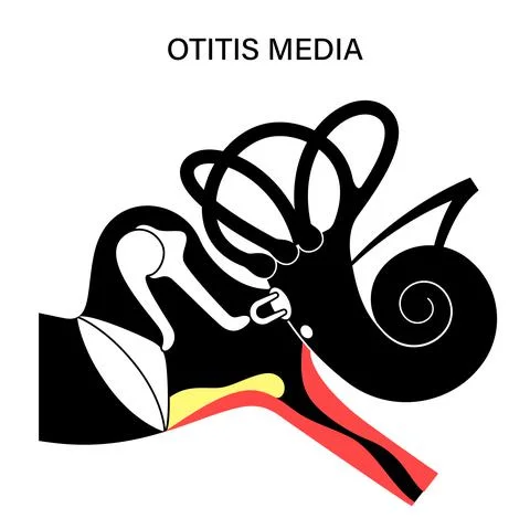 Otitis media disease Stock Illustration
