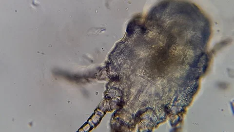 Otodectes cynotis or ear scabies 스톡 동영상 120950004